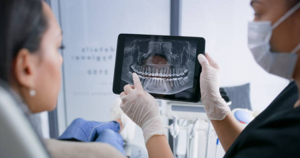 Licensed Dental Implants service in West Hollywood, CA - Smile Center Dentistry