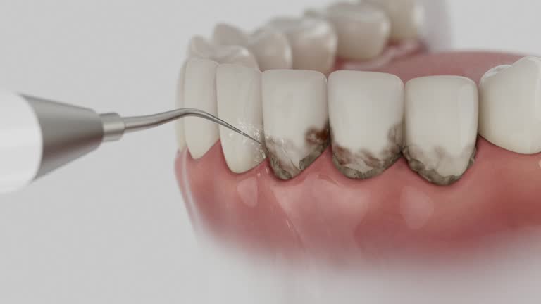 Reliable Dental Implants contractor in West Hollywood, CA by Smile Center Dentistry